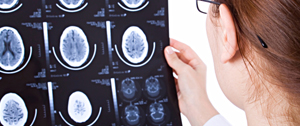 Neurologia